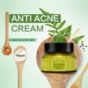 Natural face whitening cream remove acne pimples acnes anti-acne cream for ance 3